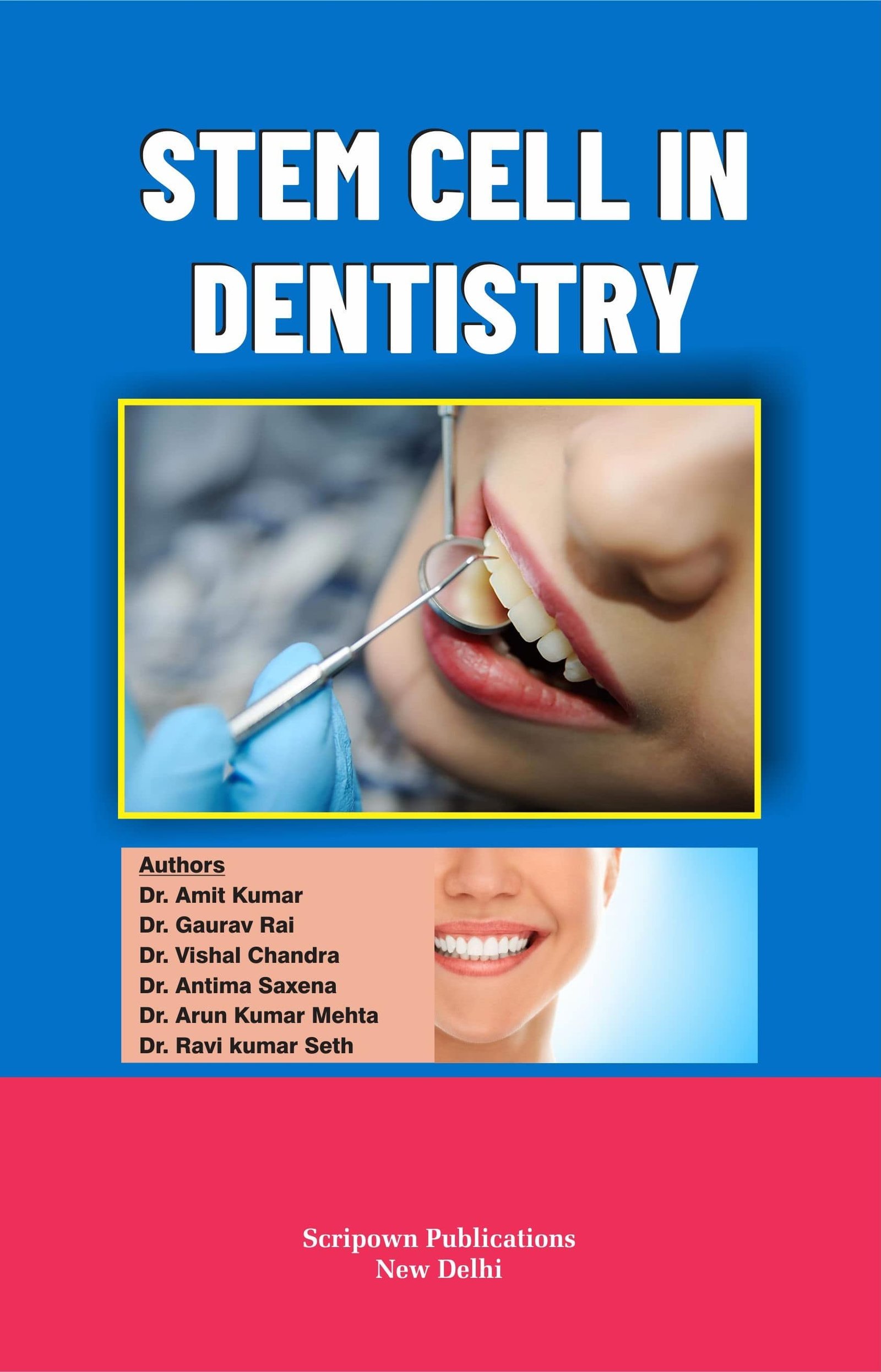 Stem Cell in Dentistry