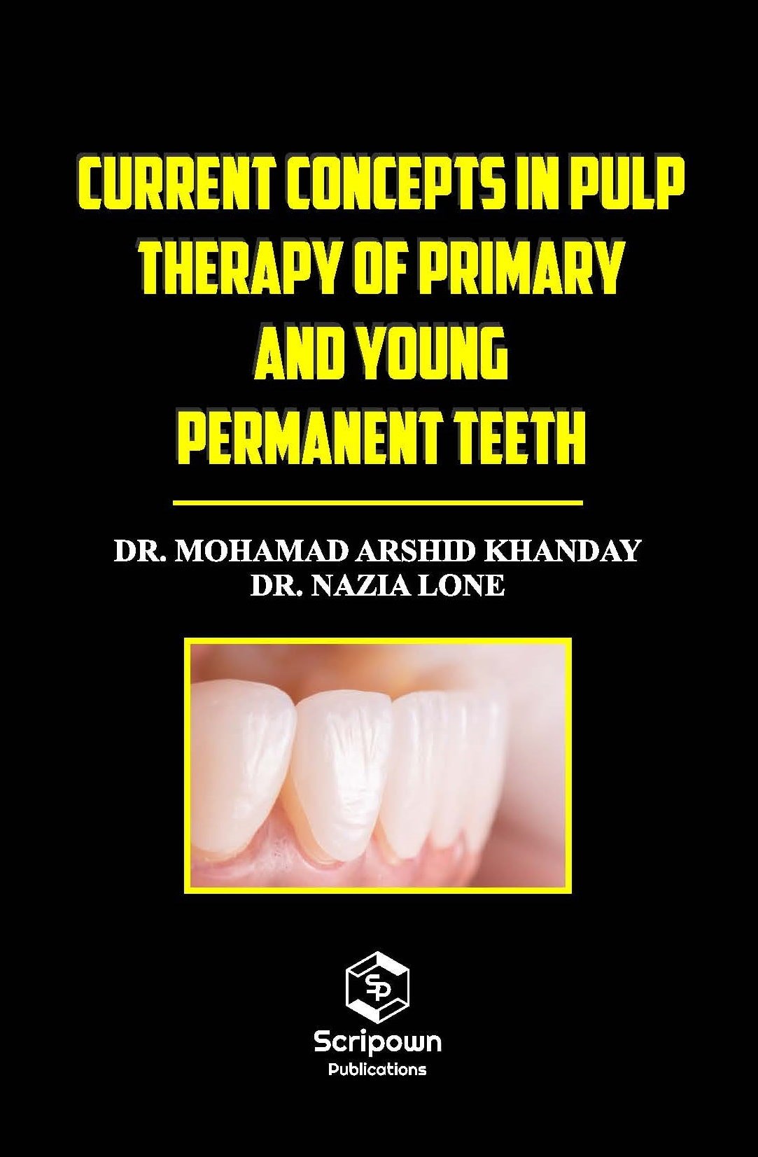 Current Concepts in Pulp Therapy of Primary and Young Permanent Teeth